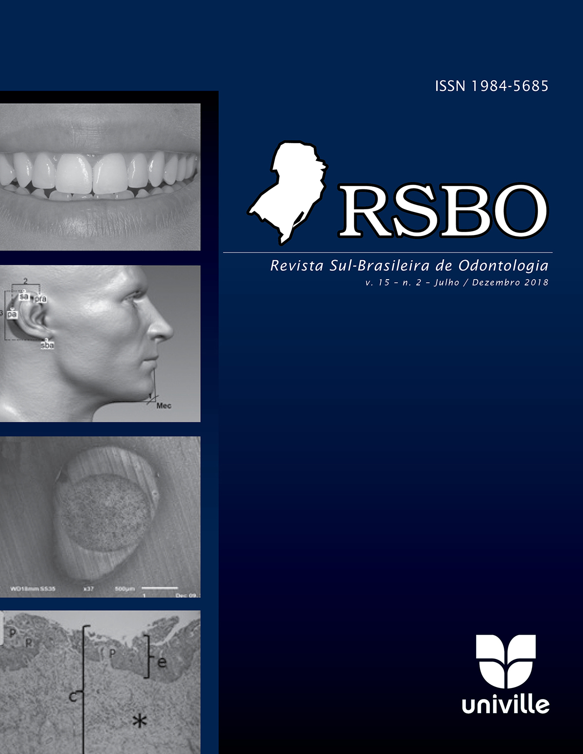 					Visualizar v. 16 n. 2 (2019): Revista Sul-Brasileira de Odontologia - 2019.jul-dez
				