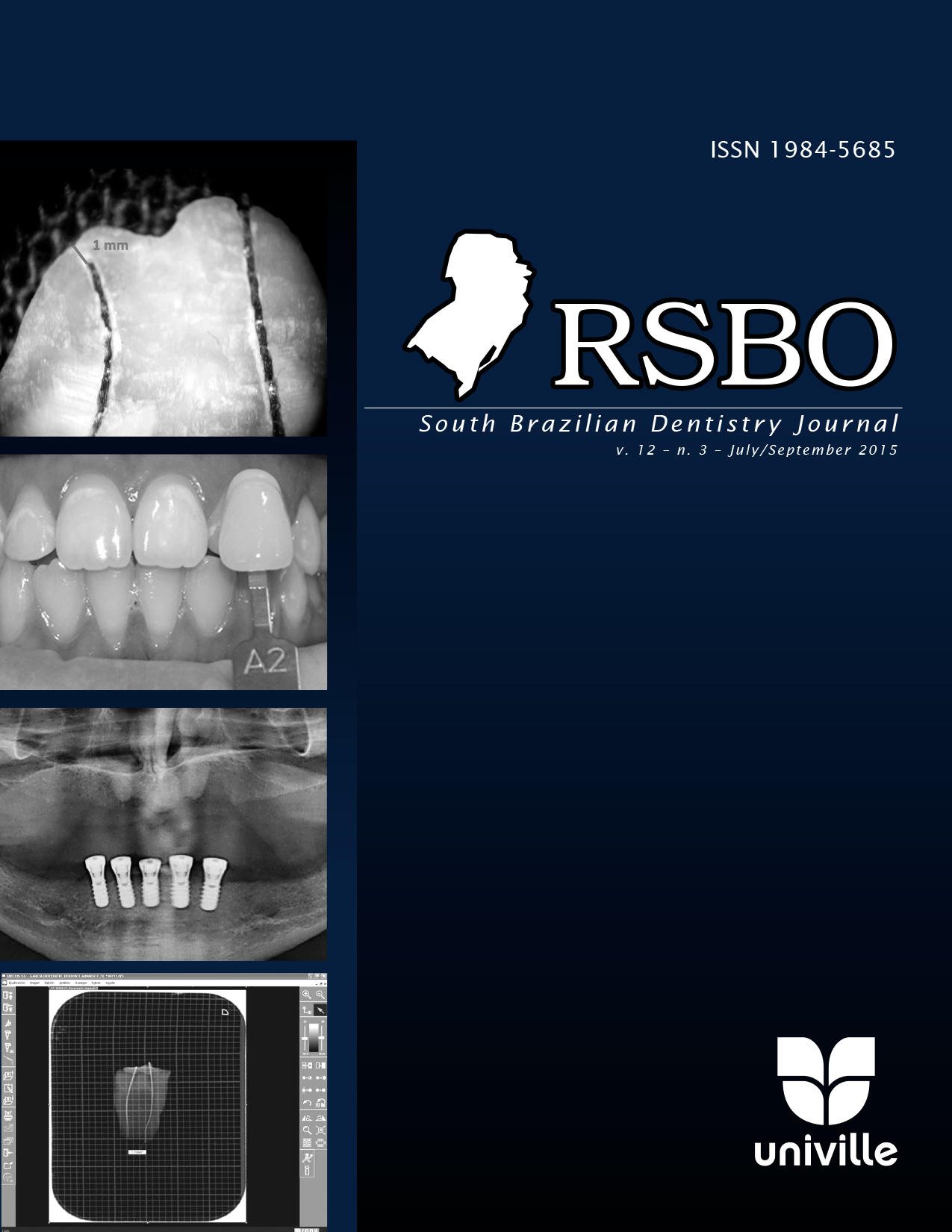 					Visualizar v. 12 n. 3 (2015): Revista Sul-Brasileira de Odontologia - 2015.Jul-Sep
				