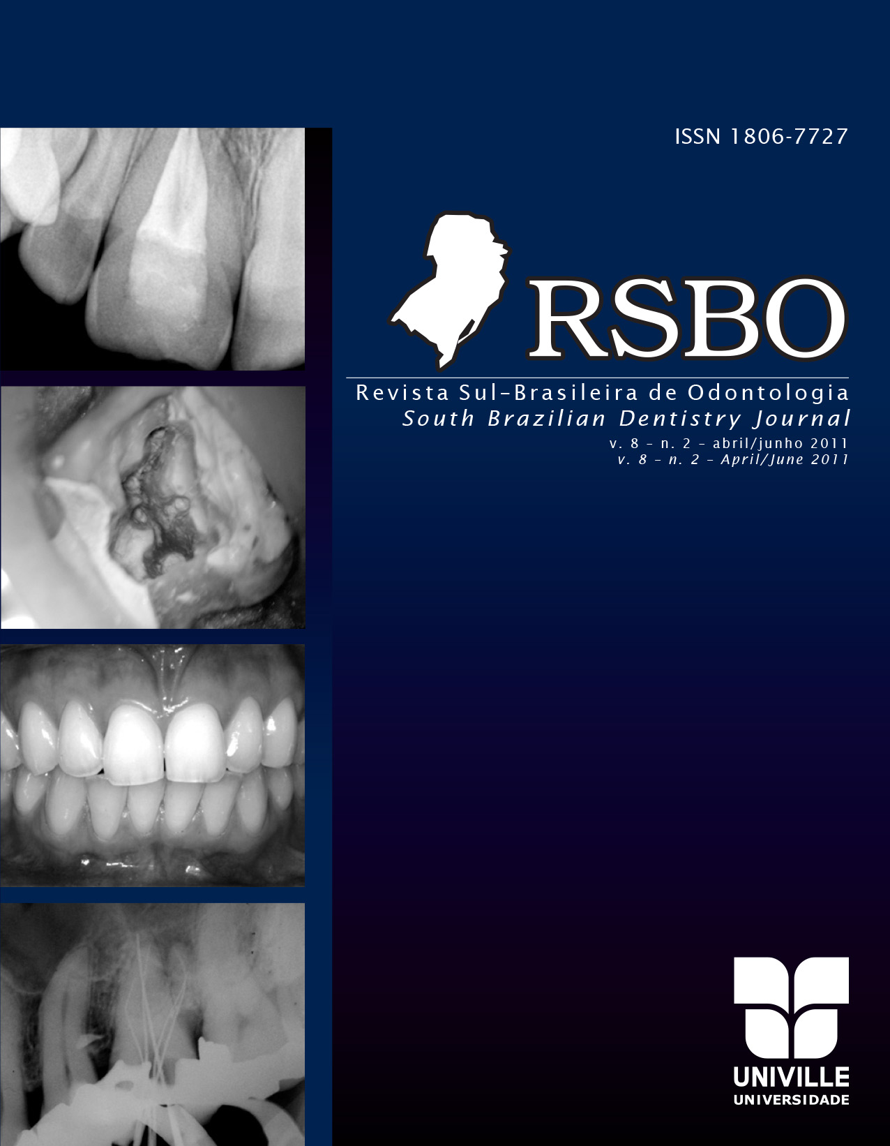 					Visualizar v. 8 n. 2 (2011): Revista Sul-Brasileira de Odontologia - 2011. Apr-Jun
				